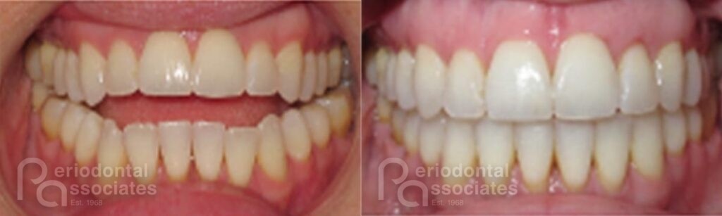 periodontal associates charleston paoo patient1g